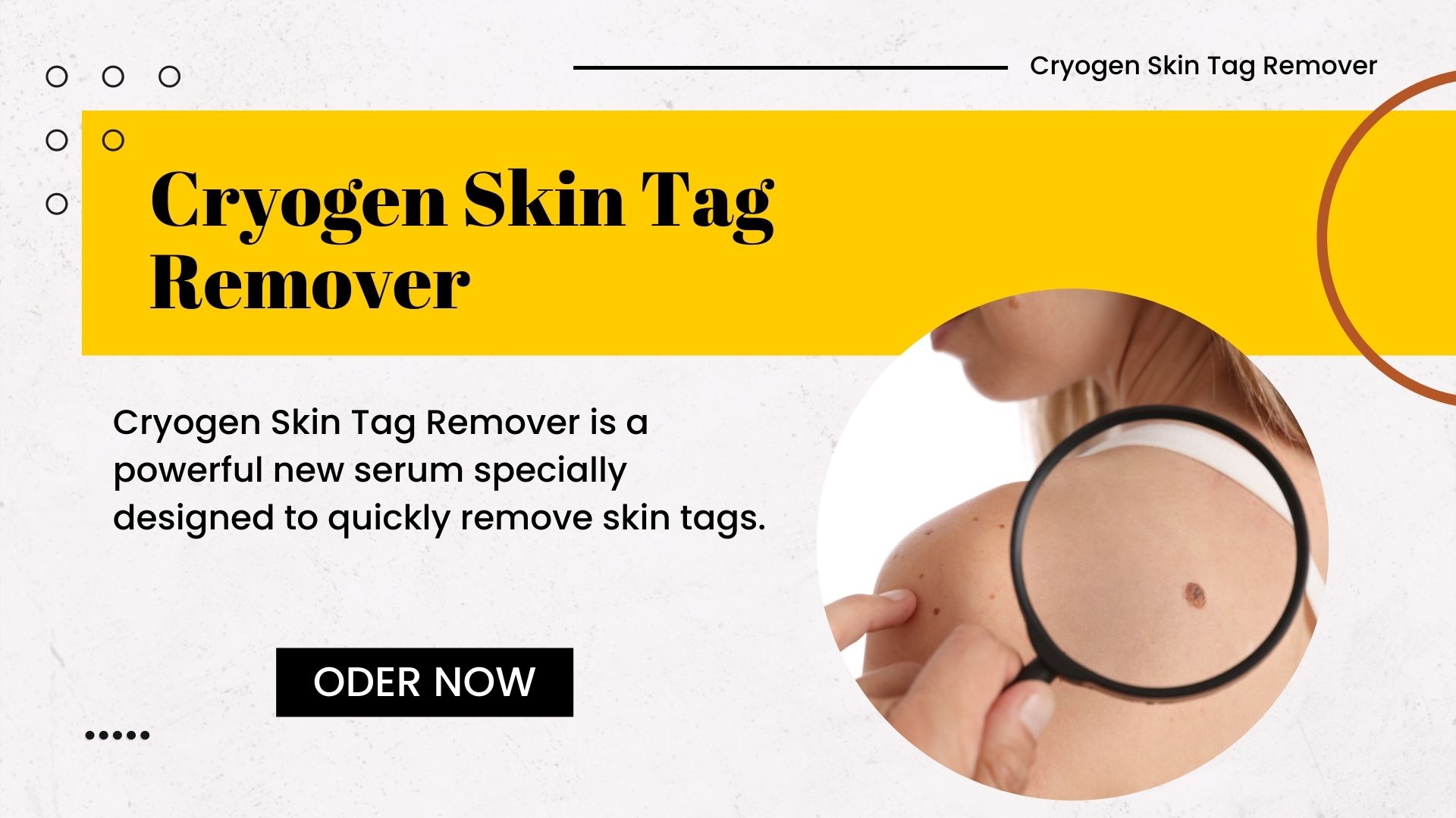 100% Official Cryogen Skin Tag Remover - Shark-Tank Episode